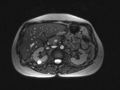 МРТ почек и надпочечников: когда может потребоваться исследование?
