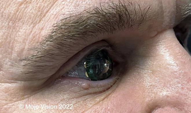 Mojo Vision разработала контактные линзы с поддержкой дополненной реальности